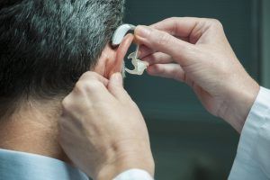 Risk of Dementia and Alzheimer’s in Untreated Hearing Loss